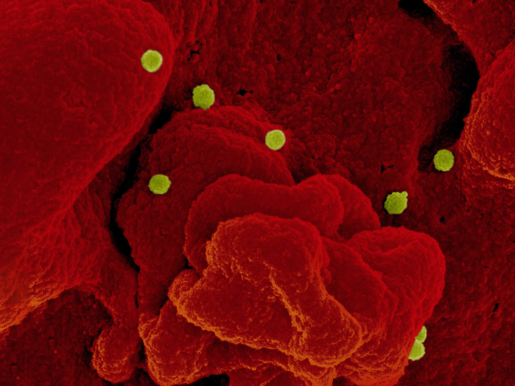 SCP-016 지각 있는 미생물 관련 - 출혈열 바이러스 입자의 전자 현미경 사진