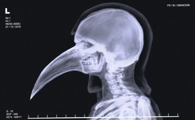 SCP-049 X-Ray 영상 - 부리 마스크 아래 인간형 두개골 구조가 확인된다