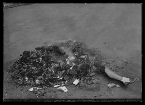 SCP-081 자연발화 바이러스 - 바이러스 감염 관련 의학 이미지