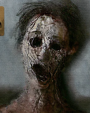 SCP-106 피해자 - 포켓 차원에서 풀려난 요원의 상태